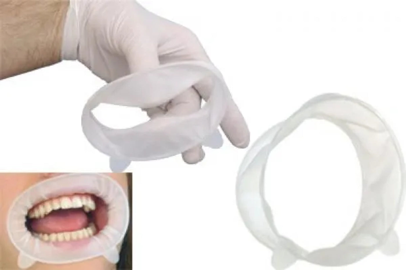 OptraGate Latex Free Cheek Retractor (China) 1pc